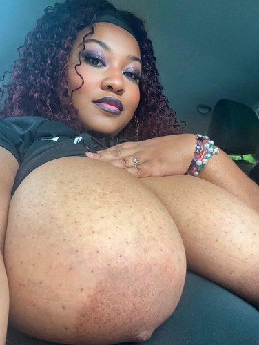 Areola_Fein