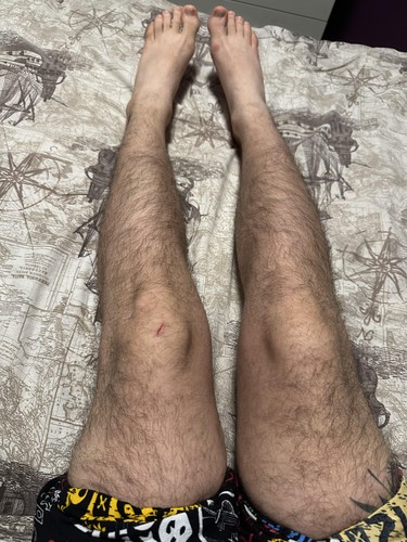 guyshairylegs