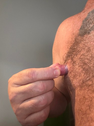 malenipplesuction