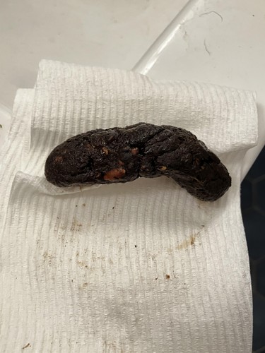 poop